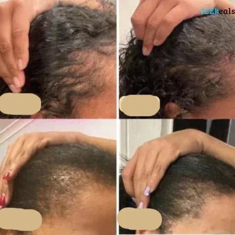 Haarwuchsöl | Fördert Haarwachstum Gegen Haarausfall